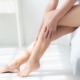 What is the recovery time after treatment of varicose veins?